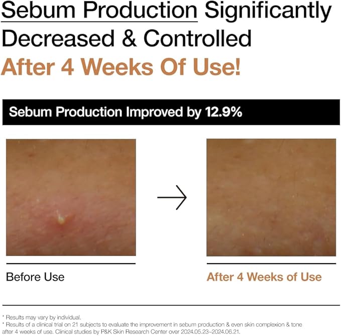 Anua Rice 70 Glow Milky Toner | 250ml (Original)