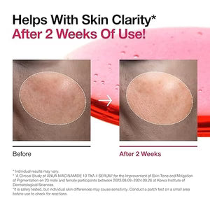 Anua Niacinamide 10% + TXA 4% Serum | 30ml (Orig)